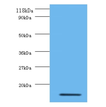 Interleukin-8 Polyclonal Antibody from Signalway Antibody (42502) - Antibodies.com