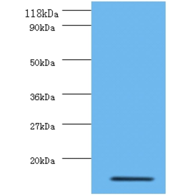 Interleukin-8 Polyclonal Antibody from Signalway Antibody (42502) - Antibodies.com