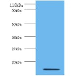 Interleukin-8 Polyclonal Antibody from Signalway Antibody (42502) - Antibodies.com