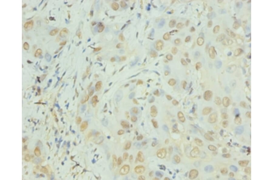 Immunohistochemistry - Interleukin-8 Polyclonal Antibody from Signalway Antibody (42502) - Antibodies.com