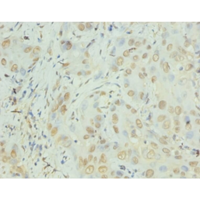 Immunohistochemistry - Interleukin-8 Polyclonal Antibody from Signalway Antibody (42502) - Antibodies.com