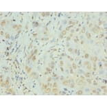 Immunohistochemistry - Interleukin-8 Polyclonal Antibody from Signalway Antibody (42502) - Antibodies.com