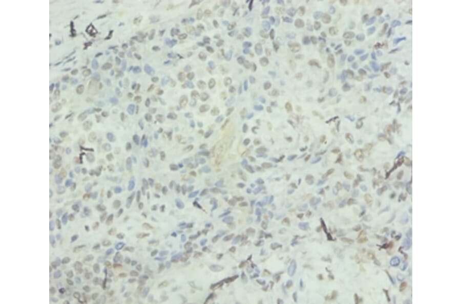 Immunohistochemistry - Interleukin-8 Polyclonal Antibody from Signalway Antibody (42502) - Antibodies.com