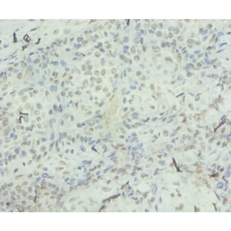 Immunohistochemistry - Interleukin-8 Polyclonal Antibody from Signalway Antibody (42502) - Antibodies.com