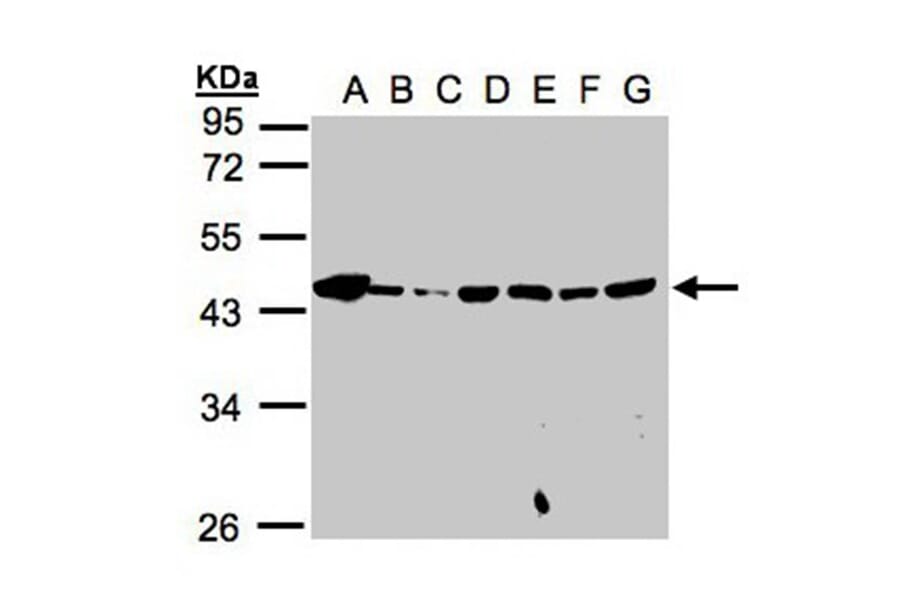 MPI antibody from Signalway Antibody (22051) - Antibodies.com