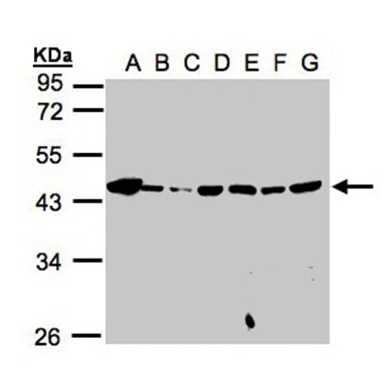 MPI antibody from Signalway Antibody (22051) - Antibodies.com