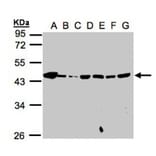 MPI antibody from Signalway Antibody (22051) - Antibodies.com