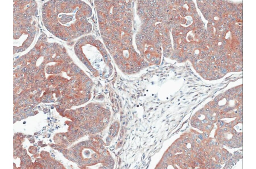 Immunohistochemistry - MPI antibody from Signalway Antibody (22051) - Antibodies.com
