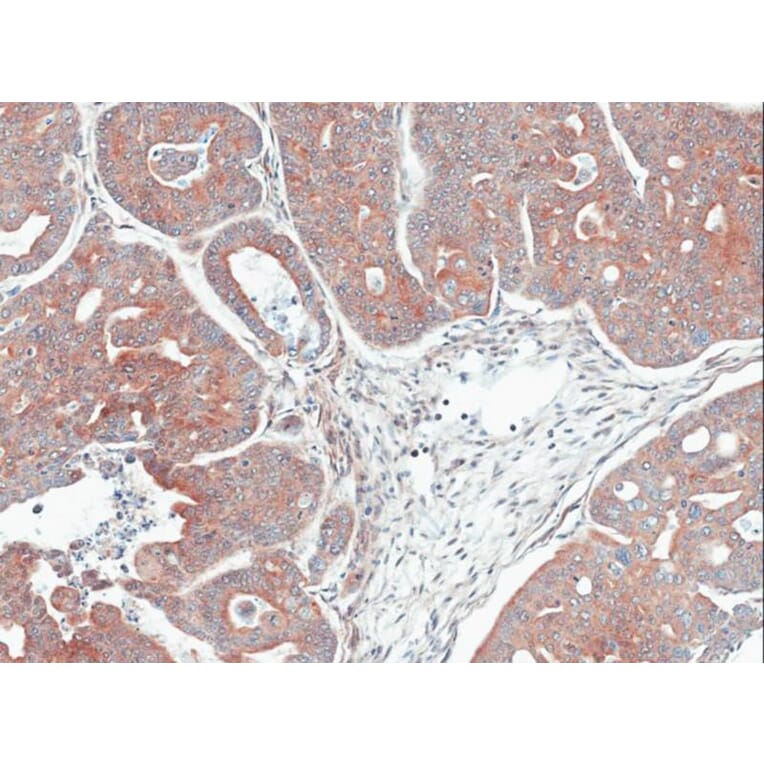 Immunohistochemistry - MPI antibody from Signalway Antibody (22051) - Antibodies.com