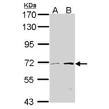 COT antibody from Signalway Antibody (22076) - Antibodies.com