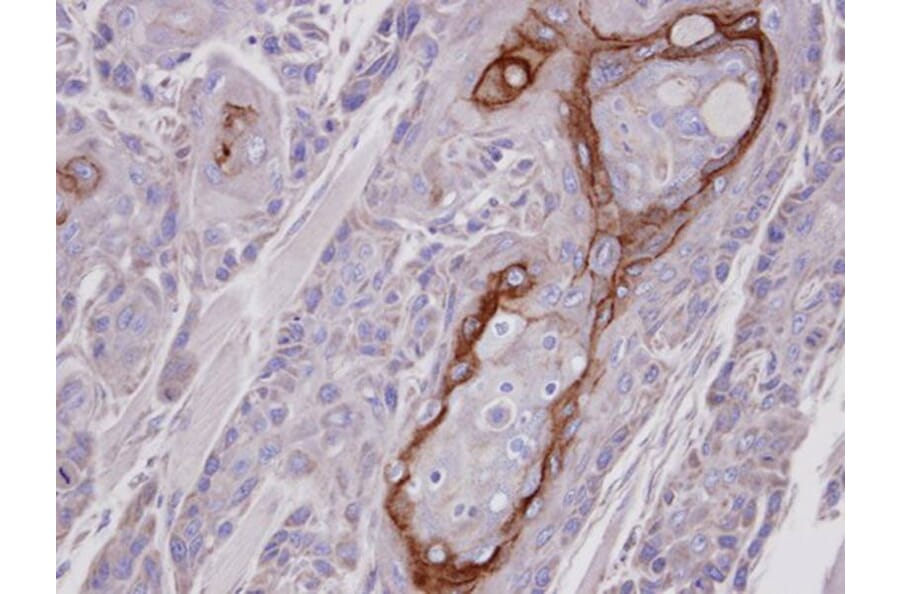 Immunohistochemistry - COT antibody from Signalway Antibody (22076) - Antibodies.com