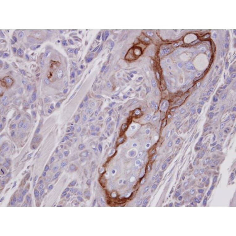 Immunohistochemistry - COT antibody from Signalway Antibody (22076) - Antibodies.com