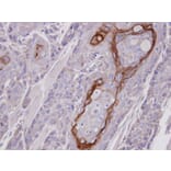 Immunohistochemistry - COT antibody from Signalway Antibody (22076) - Antibodies.com