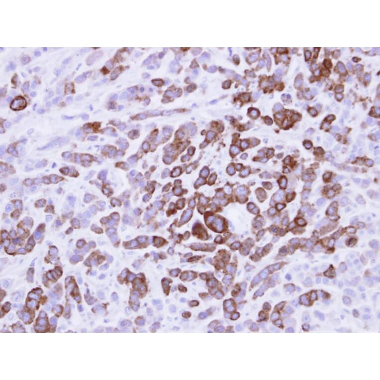 Immunohistochemistry - MX1 antibody from Signalway Antibody (22124) - Antibodies.com