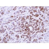 Immunohistochemistry - MX1 antibody from Signalway Antibody (22124) - Antibodies.com