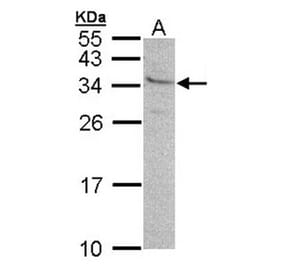 GEM antibody from Signalway Antibody (22426) - Antibodies.com