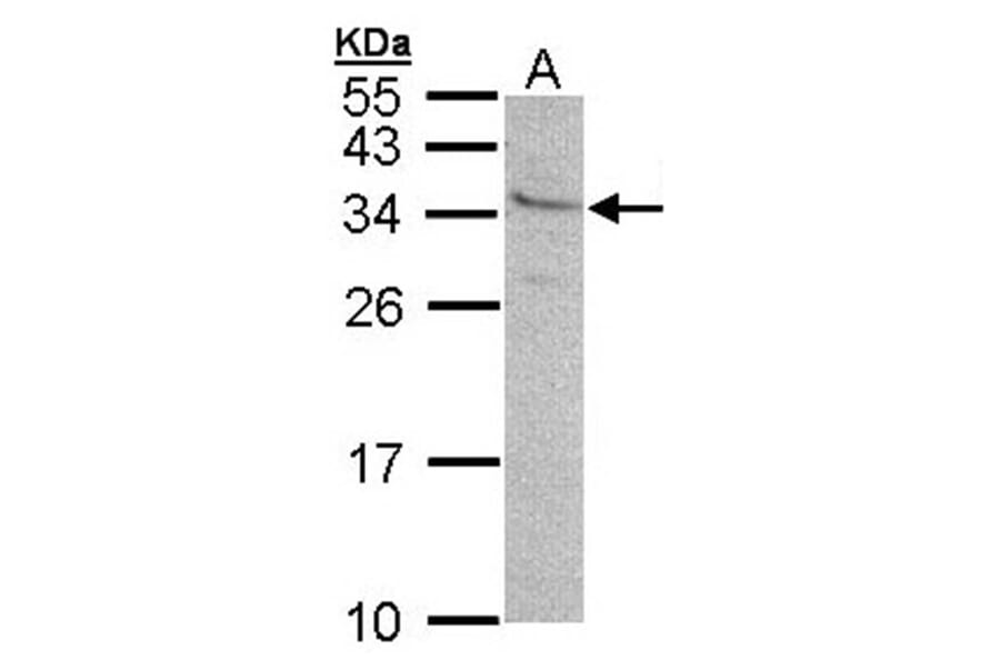 GEM antibody from Signalway Antibody (22426) - Antibodies.com