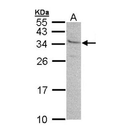 GEM antibody from Signalway Antibody (22426) - Antibodies.com