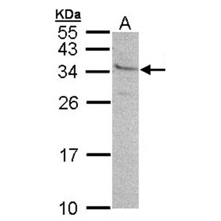 GEM antibody from Signalway Antibody (22426) - Antibodies.com