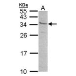 GEM antibody from Signalway Antibody (22426) - Antibodies.com