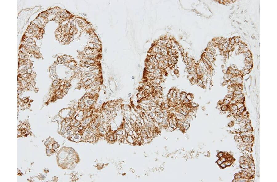 Immunohistochemistry - GEM antibody from Signalway Antibody (22426) - Antibodies.com