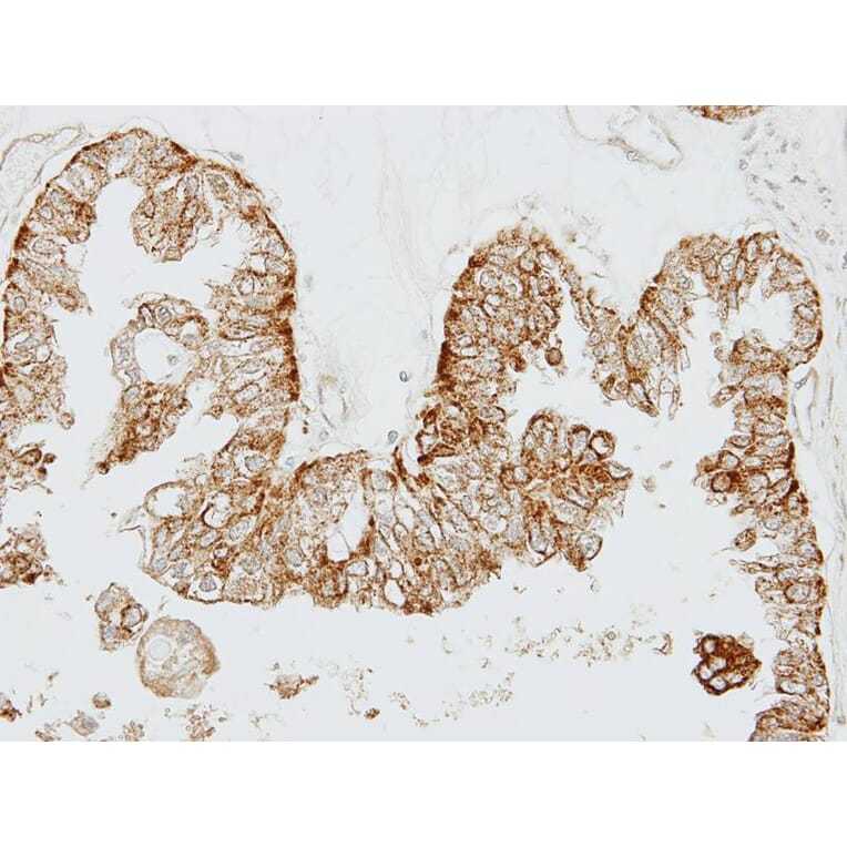 Immunohistochemistry - GEM antibody from Signalway Antibody (22426) - Antibodies.com