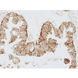 Immunohistochemistry - GEM antibody from Signalway Antibody (22426) - Antibodies.com