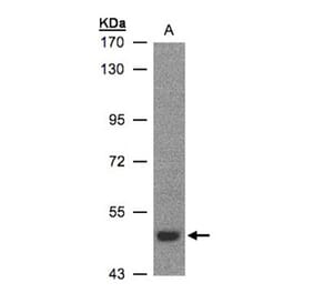 LBP antibody from Signalway Antibody (22607) - Antibodies.com