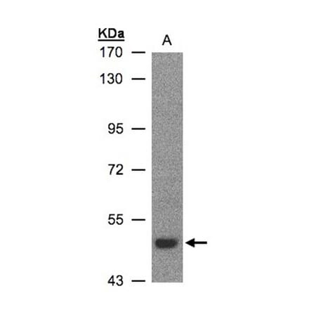 LBP antibody from Signalway Antibody (22607) - Antibodies.com