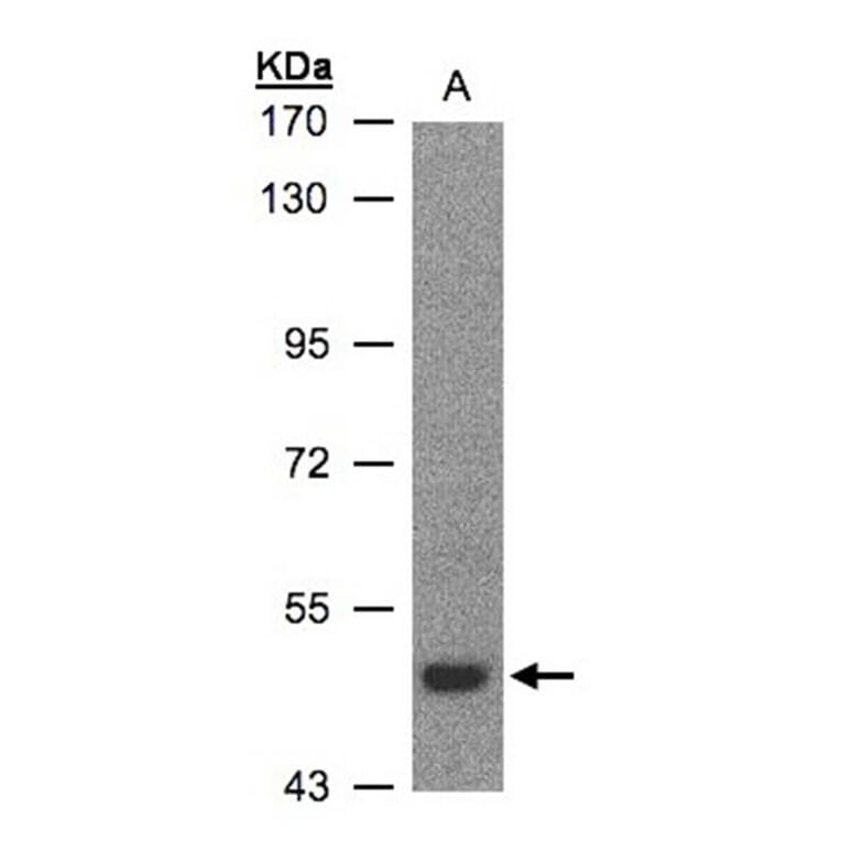 LBP antibody from Signalway Antibody (22607) - Antibodies.com