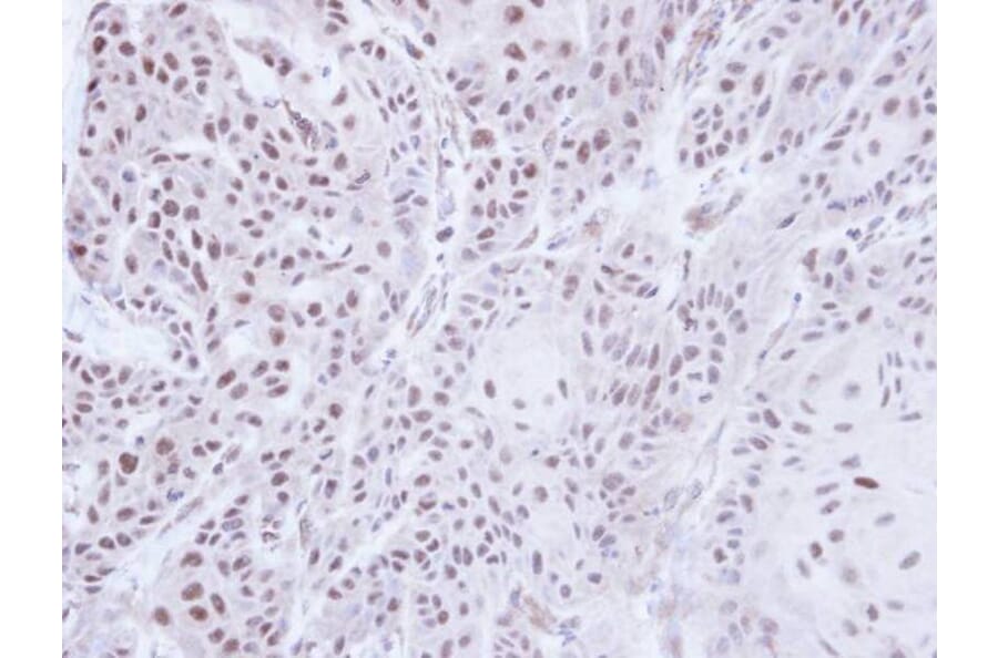 Immunohistochemistry - PSR antibody from Signalway Antibody (22697) - Antibodies.com