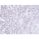 Immunohistochemistry - PSR antibody from Signalway Antibody (22697) - Antibodies.com