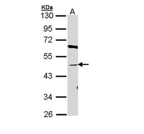 BAT antibody from Signalway Antibody (22777) - Antibodies.com