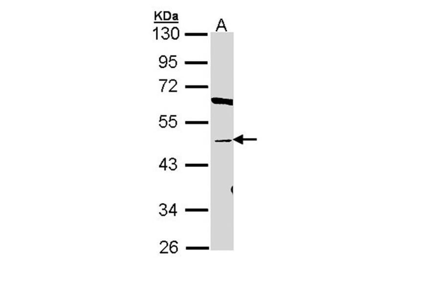 BAT antibody from Signalway Antibody (22777) - Antibodies.com
