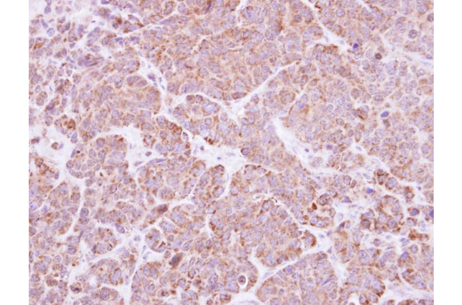 Immunohistochemistry - BAT antibody from Signalway Antibody (22777) - Antibodies.com