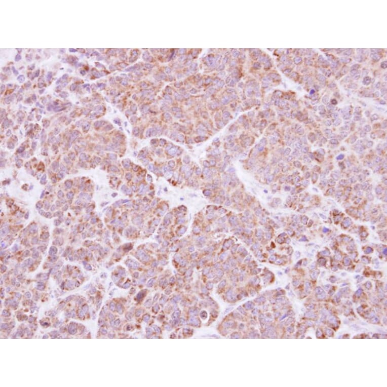 Immunohistochemistry - BAT antibody from Signalway Antibody (22777) - Antibodies.com