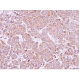 Immunohistochemistry - BAT antibody from Signalway Antibody (22777) - Antibodies.com