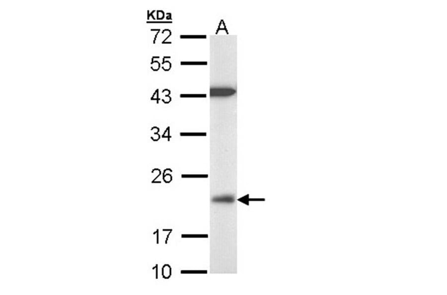 VHR antibody from Signalway Antibody (22779) - Antibodies.com