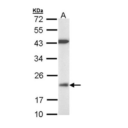 VHR antibody from Signalway Antibody (22779) - Antibodies.com