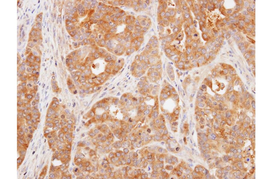 Immunohistochemistry - VHR antibody from Signalway Antibody (22779) - Antibodies.com