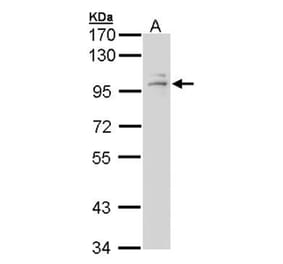 GR antibody from Signalway Antibody (23008) - Antibodies.com