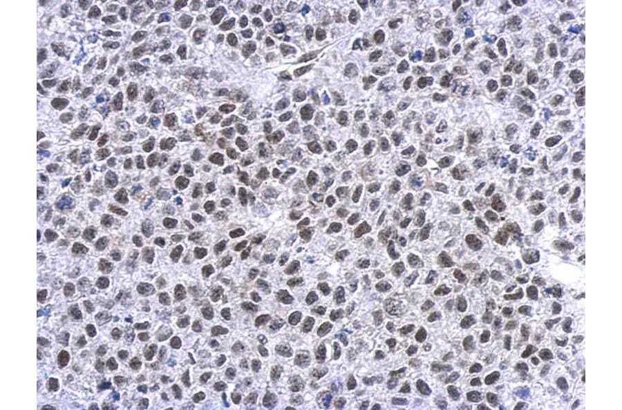 Immunohistochemistry - GR antibody from Signalway Antibody (23008) - Antibodies.com