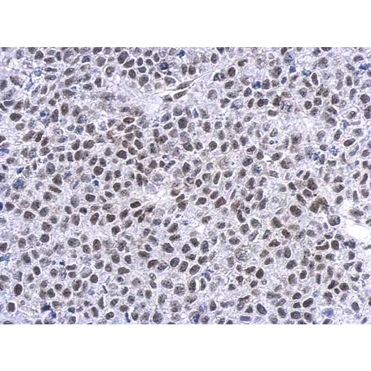Immunohistochemistry - GR antibody from Signalway Antibody (23008) - Antibodies.com