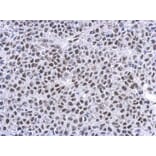 Immunohistochemistry - GR antibody from Signalway Antibody (23008) - Antibodies.com