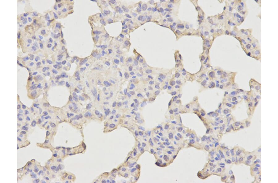 Immunohistochemistry - Bax Antibody from Signalway Antibody (32011) - Antibodies.com