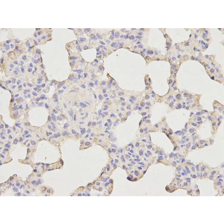 Immunohistochemistry - Bax Antibody from Signalway Antibody (32011) - Antibodies.com