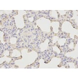 Immunohistochemistry - Bax Antibody from Signalway Antibody (32011) - Antibodies.com