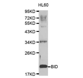 Western blot - BID Antibody from Signalway Antibody (32014) - Antibodies.com