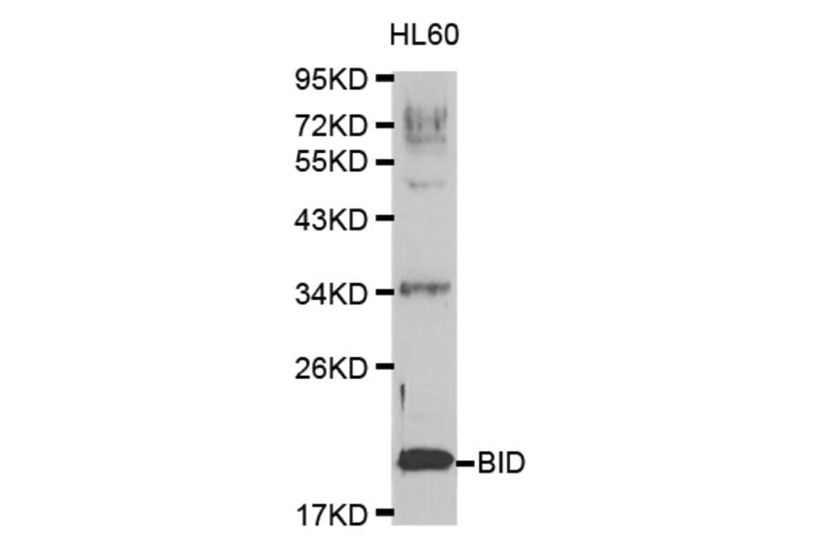 Western blot - BID Antibody from Signalway Antibody (32014) - Antibodies.com