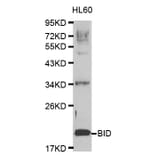 Western blot - BID Antibody from Signalway Antibody (32014) - Antibodies.com